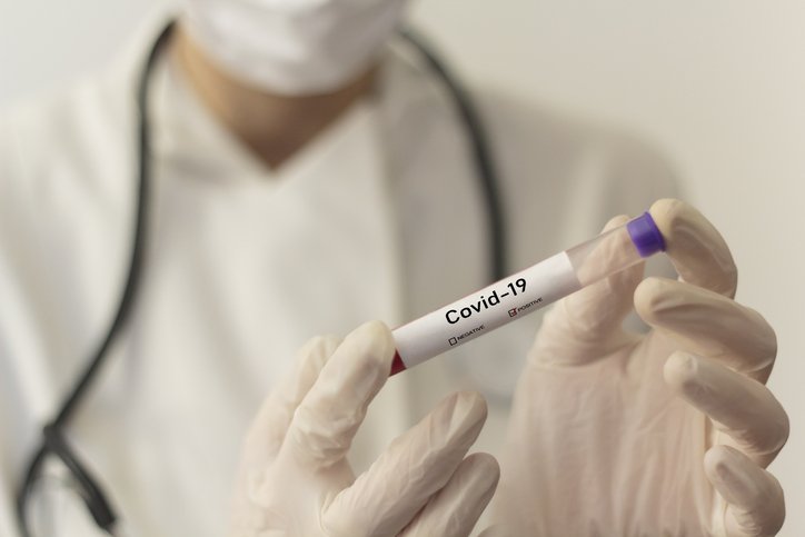 Médico con tubo de ensayo en laboratorio haciendo prueba de Covid-19. | Foto: Getty Images