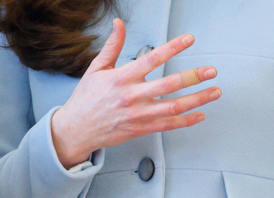 Un primer plano del dedo vendado de la Princesa Catherine durante su visita a la Academia Kensington Aldridge en Londres, Inglaterra, el 19 de enero de 2015 | Foto: Getty Images
