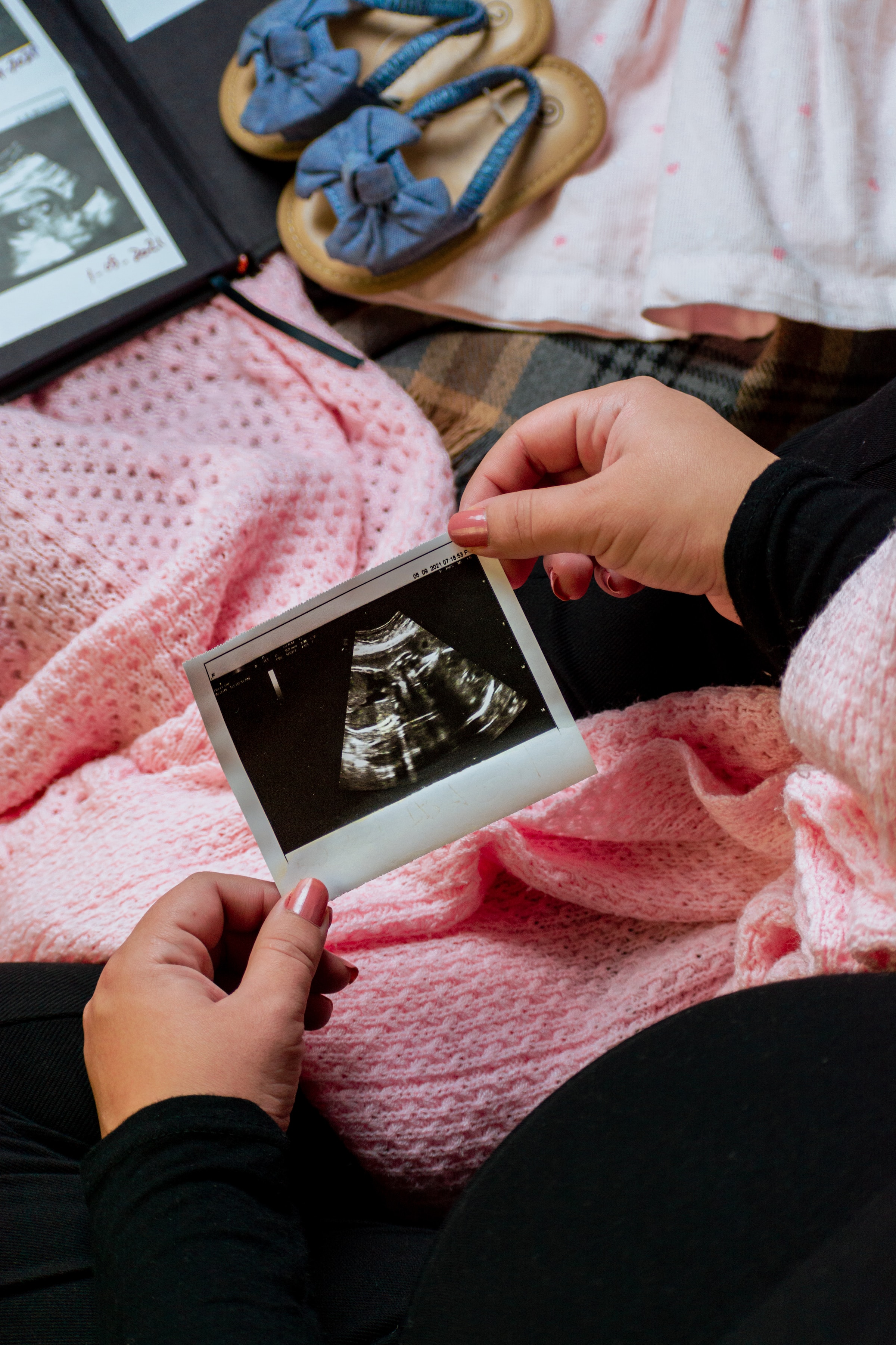 Una mujer sosteniendo una ecografía | Foto: Unsplash