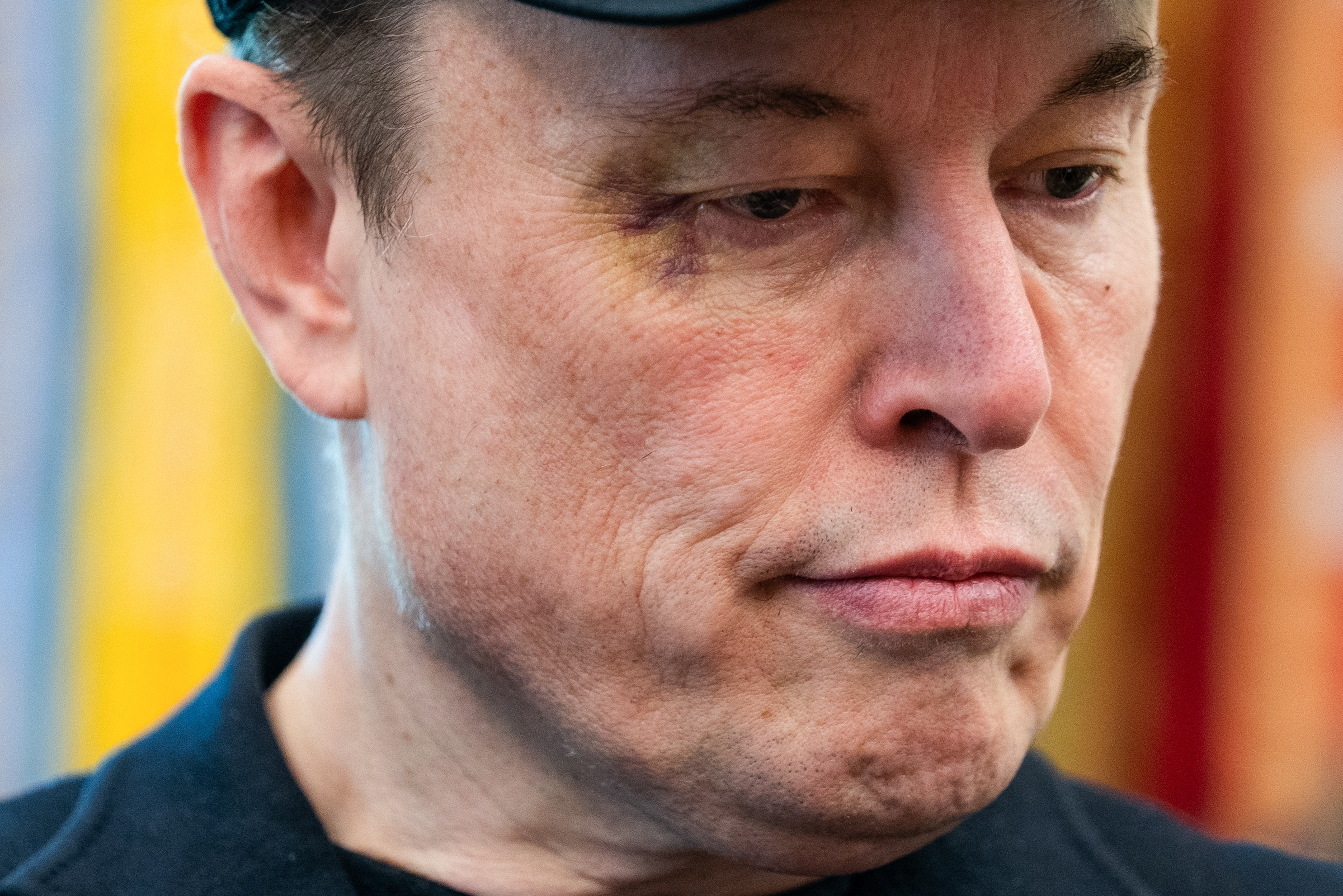 Cuando le preguntaron por la lesión, Musk explicó despreocupadamente que se la había hecho jugando con su hijo de cinco años, X Æ A-12.