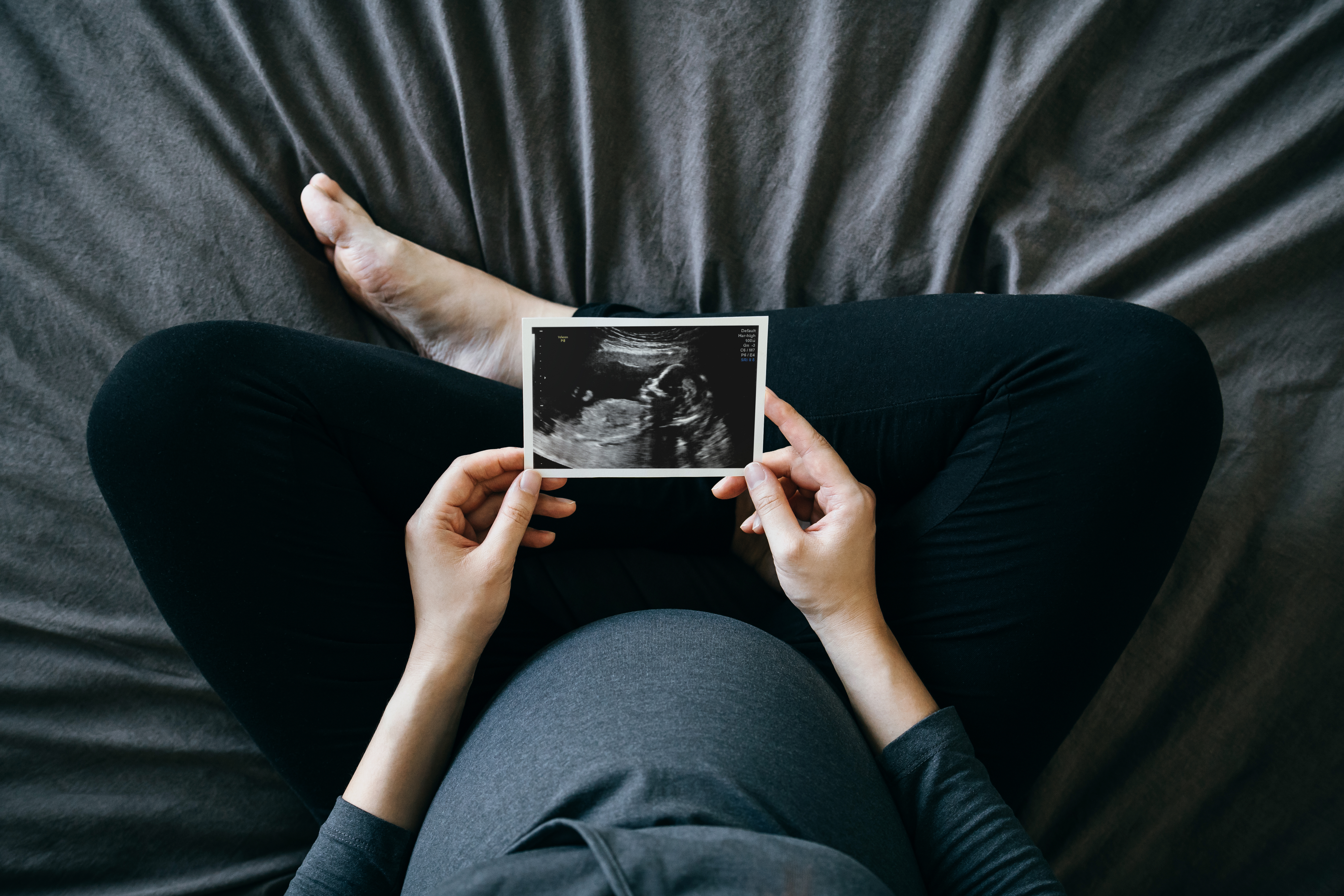 Una mujer embarazada sentada en su cama sosteniendo una foto de una ecografía | Foto: Shutterstock