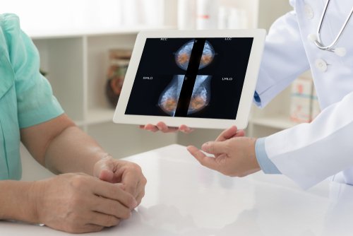 Médico mostrando radiografía computarizada a paciente. | Imagen: Shutterstock