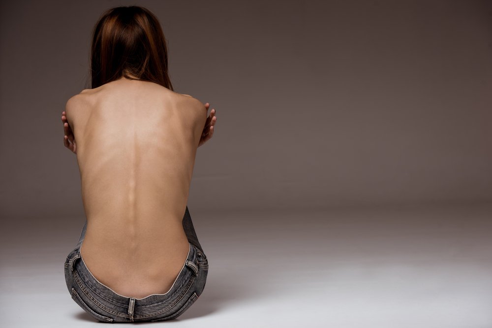Una chica con anorexia de espaldas. Fuente: Shutterstock