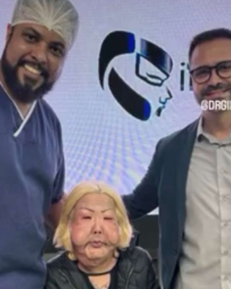 Laura Bozzo compartió una captura del video viral de su "cirugía facial" junto al mensaje en el que desmintió ser ella | Fuente: Instagram/laurabozzo_of