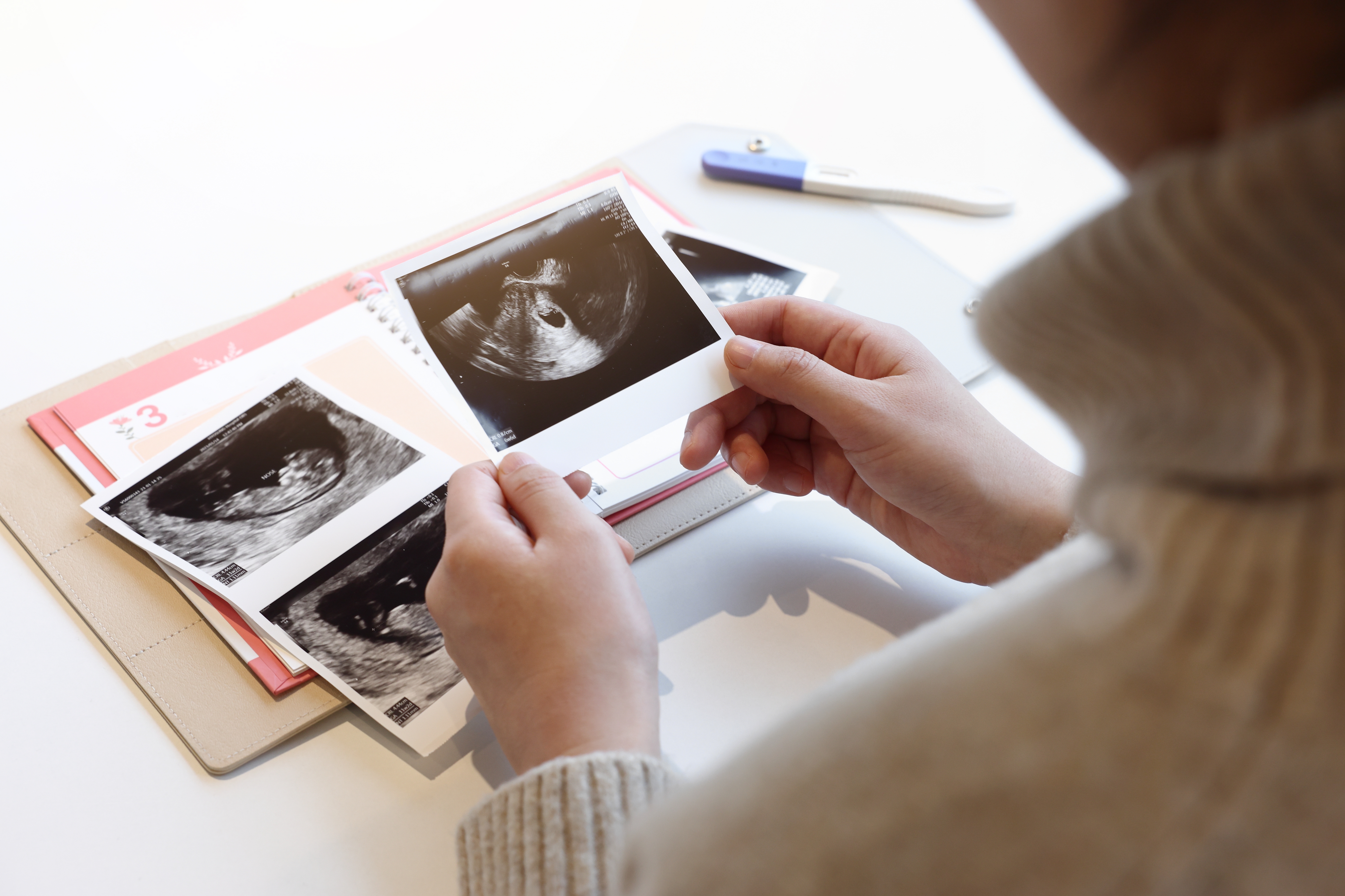 Una mujer embarazada | Fuente: Shutterstock