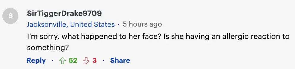 "Lo siento, ¿qué le pasó en la cara? Está teniendo una reacción alérgica a algo?" | Reacción de un internauta a la reciente salida de Ellen Pompeo. | Foto: Daily Mail