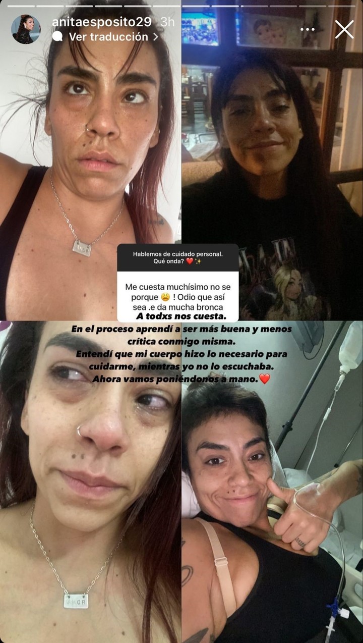 Anita Espósito mostró imágenes de su proceso de salud en sus historias de Instagram | Fuente: Instagram Stories/anitaesposito29