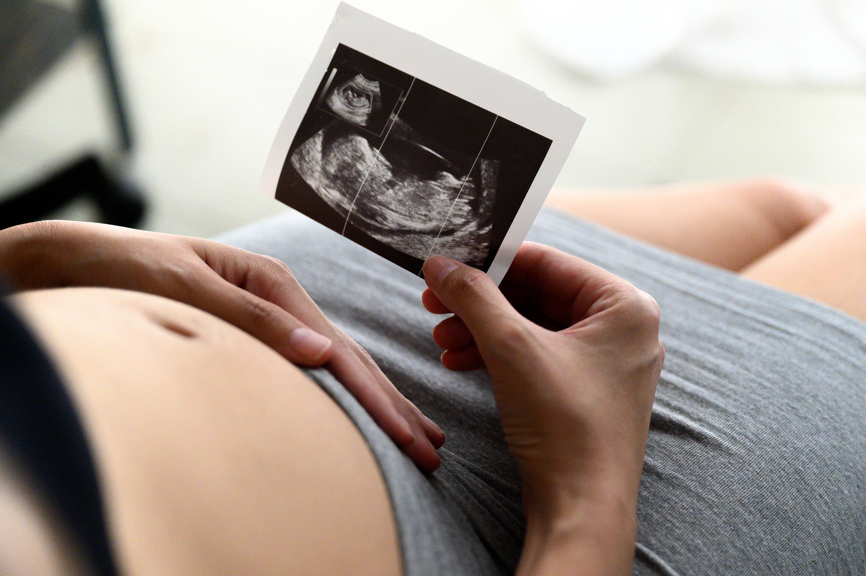 Mujer embarazada mira ultrasonido. | Foto: Shutterstock
