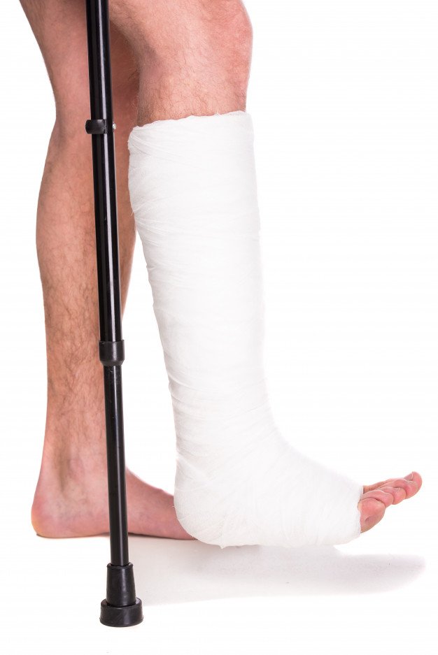 Paciente con una pierna enyesada y bastón. | Foto: Freepik