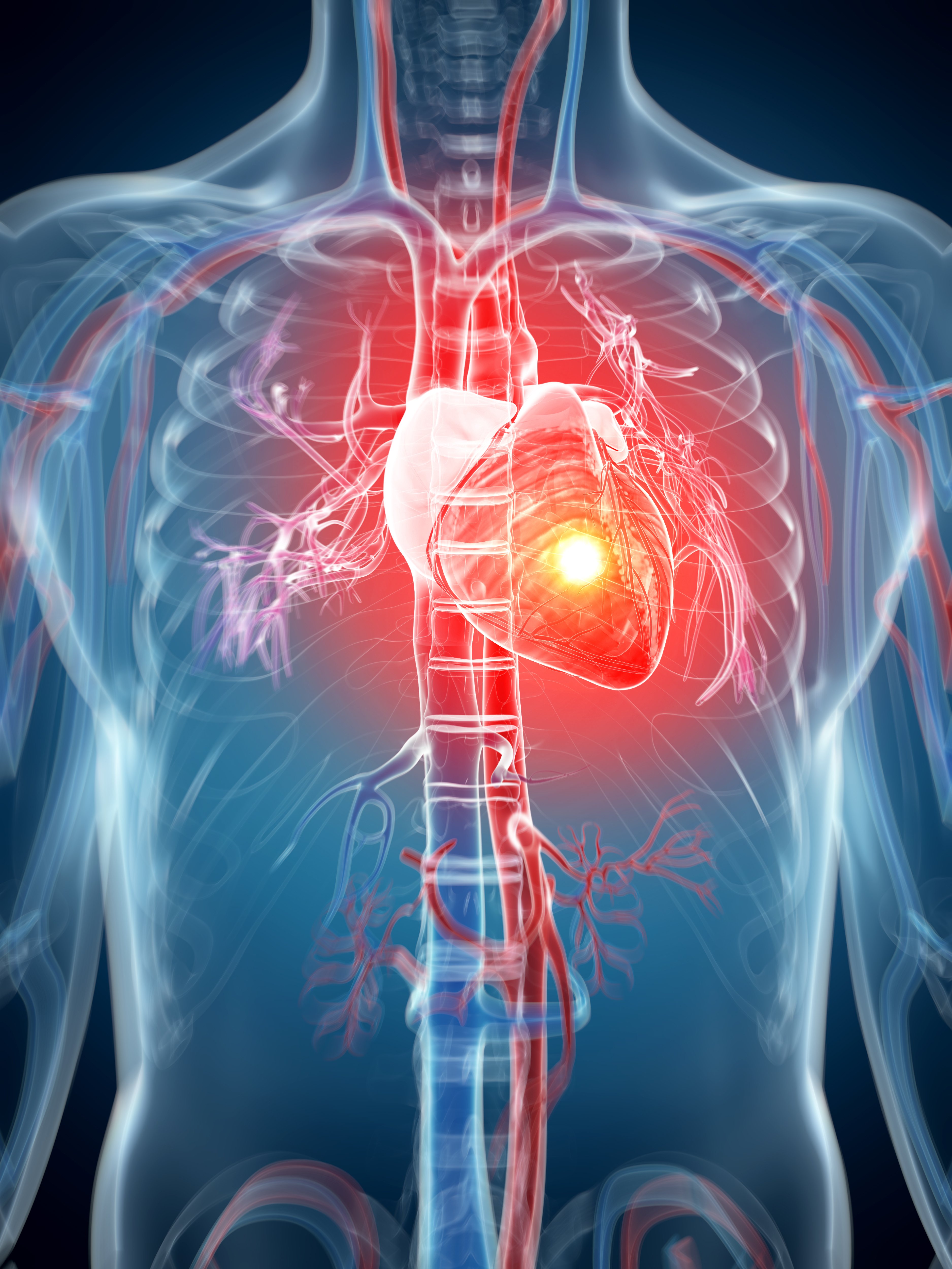 Sudoración, dolor en el pecjp y dificultad para respirar, son algunos de los síntomas de ataque al corazón. | Foto: Shutterstock