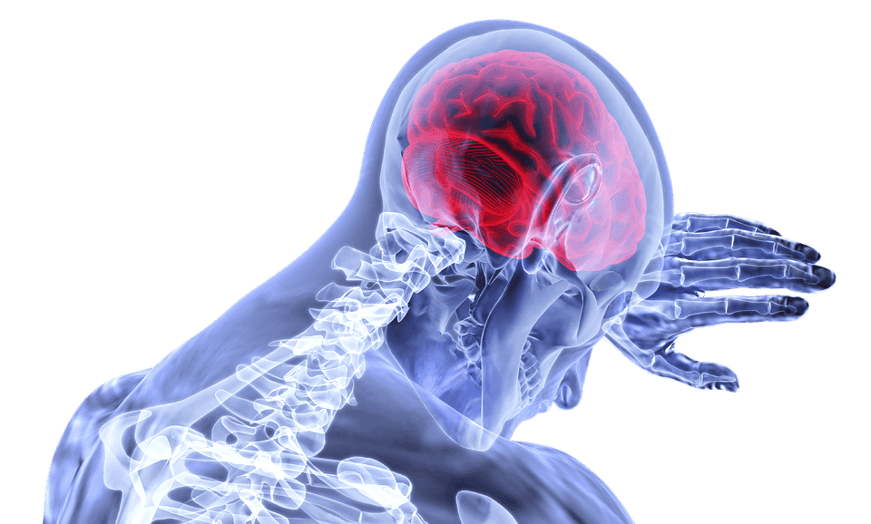 Accidente cerebrovascular. | Imagen:  Pixabay