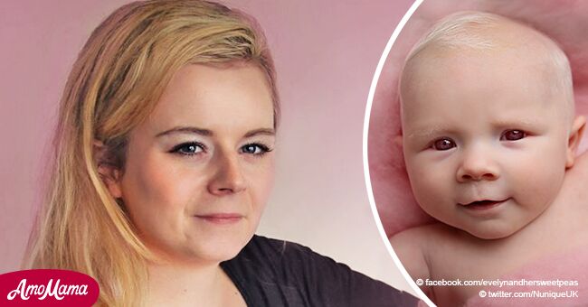 Médicos le dicen que nunca podrá tener hijos, pero ella da a luz a bebé milagro albina