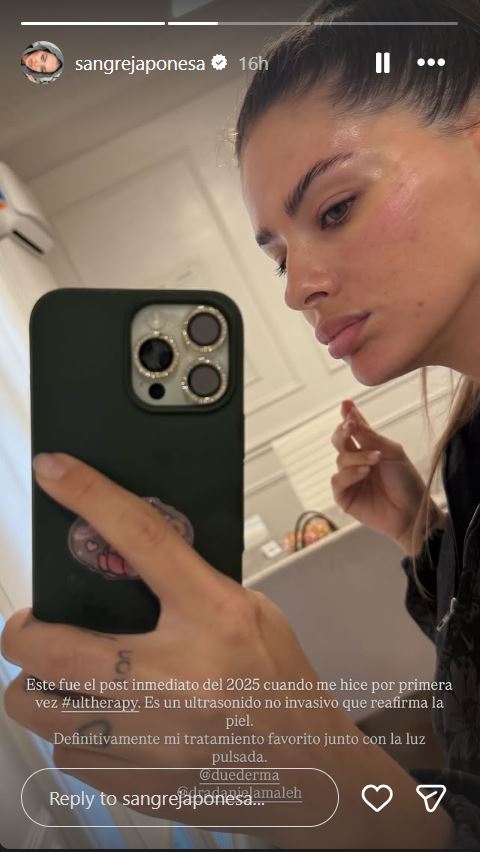 El tratamiento que promociona Eugenia "la China" Suárez de sus historias de Instagram | Fuente: Instagram/sangrejaponesa