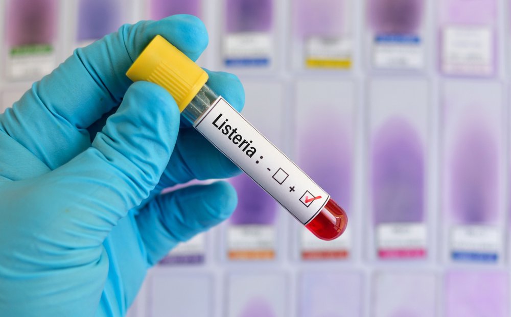 Prueba positiva de Listeria. || Fuente: Shutterstock