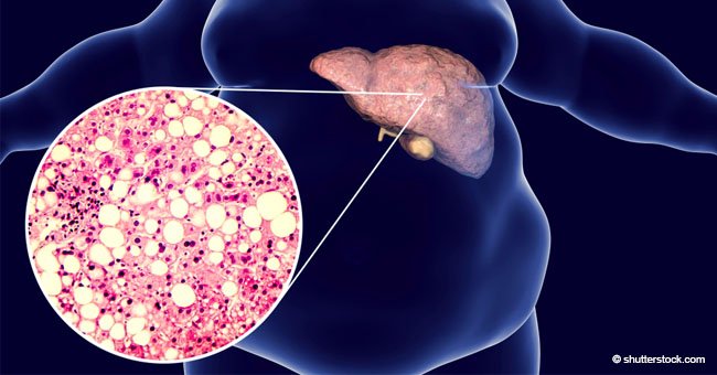 7 señales que advierten que tu hígado está saturado de toxinas