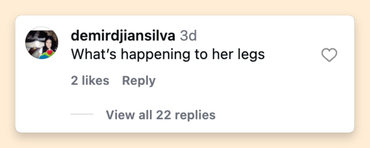 La atención que se prestó a las piernas de Griffith se convirtió rápidamente en uno de los temas más comentados en torno a las últimas fotos. Un comentarista preguntó directamente: "¿Qué está pasando con sus piernas?", lo que pone de manifiesto hasta qué punto se estaba examinando su apariencia. | Fuente: Instagram/backgrid_usa
