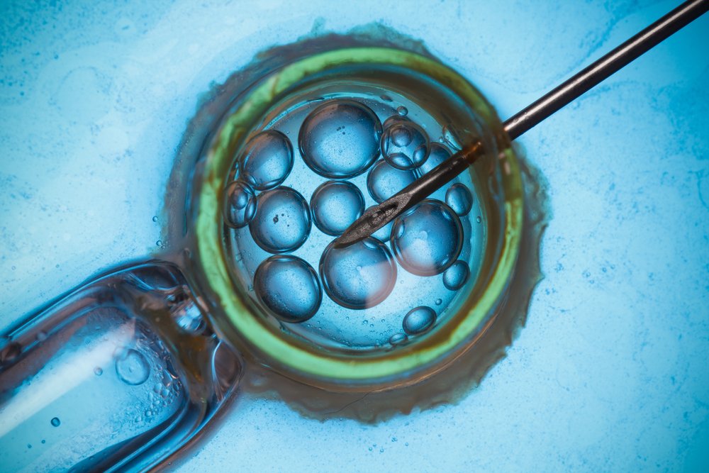 Fertilización in vitro. | Foto: Shutterstock