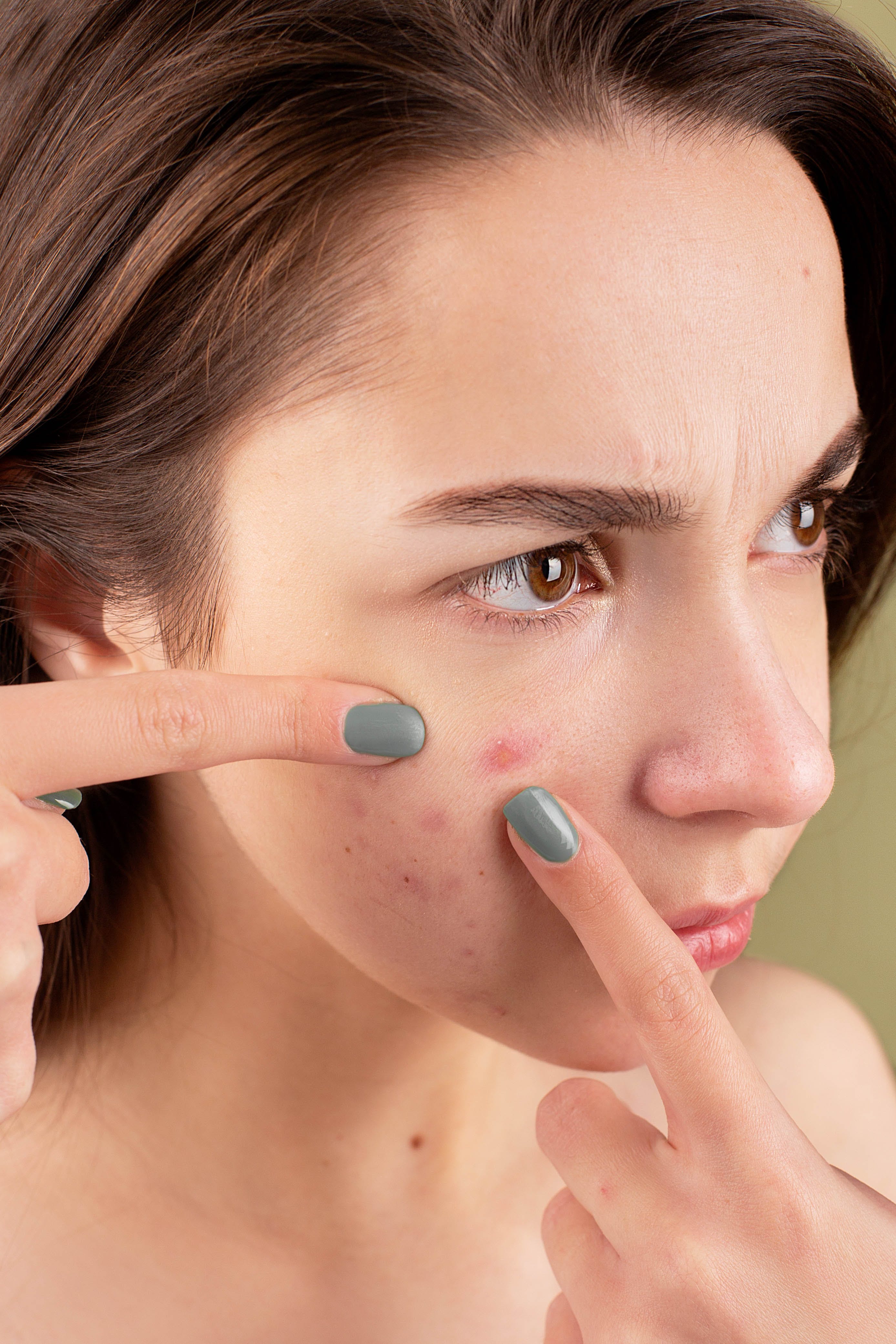 Una señora aplastándose un grano en la cara: Fuente: Pexels