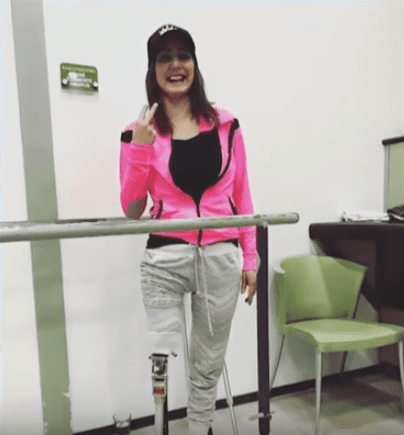 La modelo venezolana, Angélica Diaz, con su prótesis. | Fuente: YouTube / Hoy