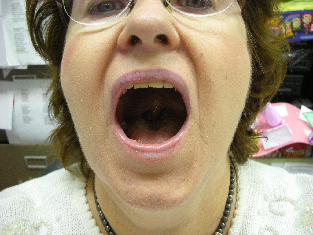 Mujer con la boca abierta. | Imagen: Flickr