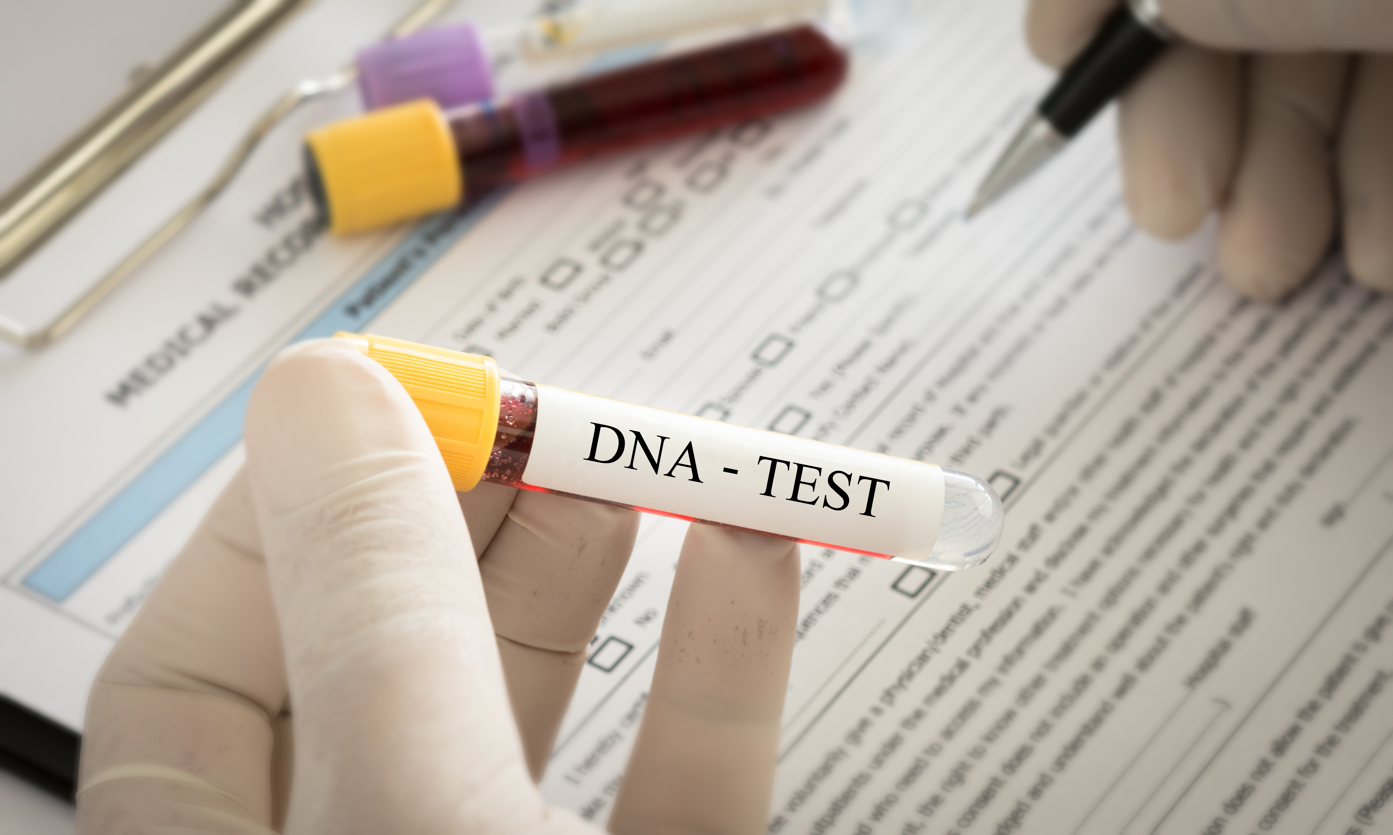 Una prueba de ADN | Foto: Getty Images