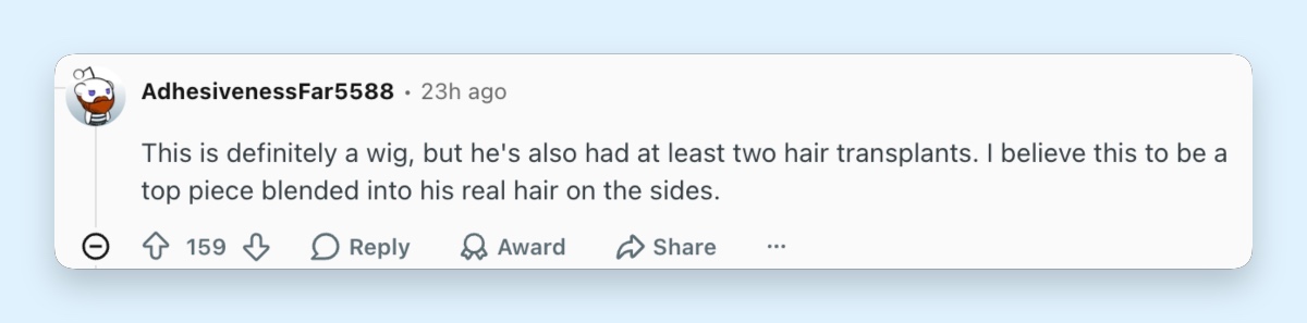 Un usuario especula sobre el cabello más abundante de Fraser y sugiere que su nuevo peinado incluye un postizo y tratamientos estéticos. | Fuente: Reddit/ r/popculturechat