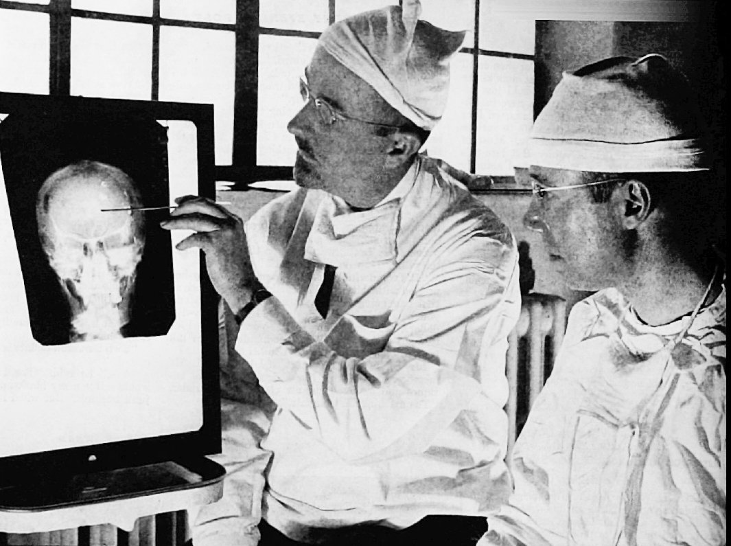 El Dr. Walter Freeman y el Dr. James W Watts, los médicos que realizaron la lobotomía de Rosemary. Foto: Wikimedia Commons