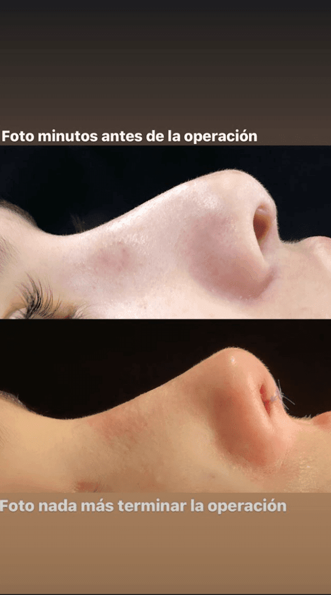 María Pombo muestra imágenes de su cirugía | Foto: Instagram / mariapombo