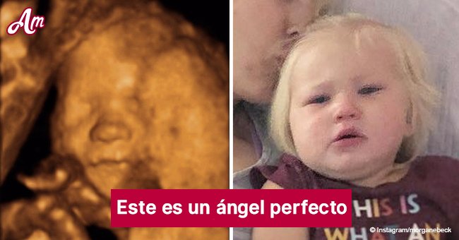 Ultrasonido de bebé muestra imagen del 'ángel' de su hermanita muerta