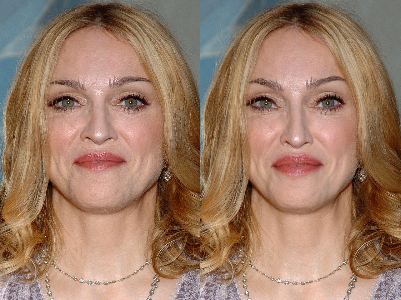 Madonna frente a cómo se vería con la Proporción Áurea | Fuente: Getty Images