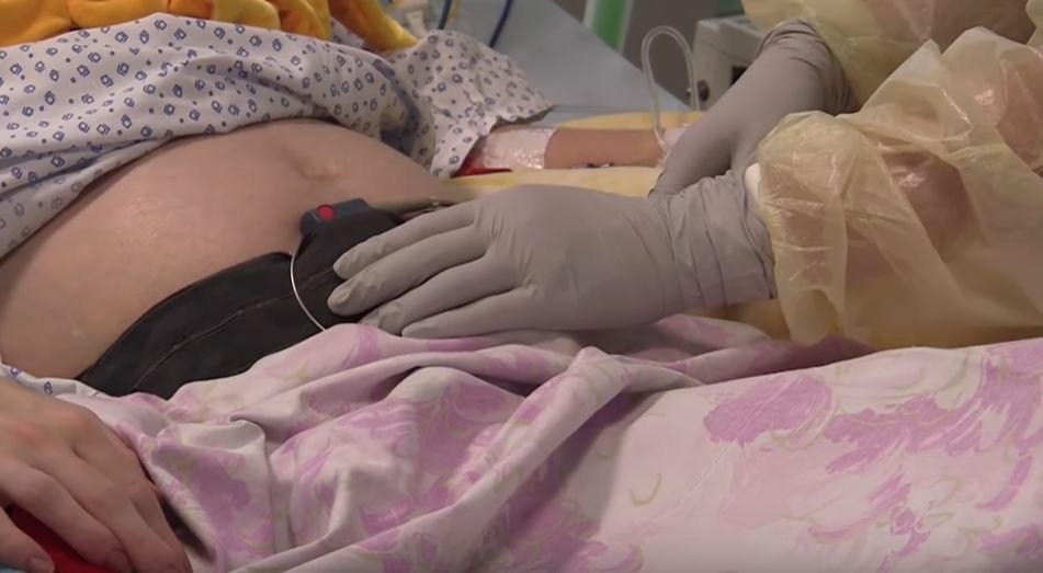 Enfermeras masajeando la barriga de la mamá de Eliska. | Foto: YouTube/Fakultní nemocnice Brno