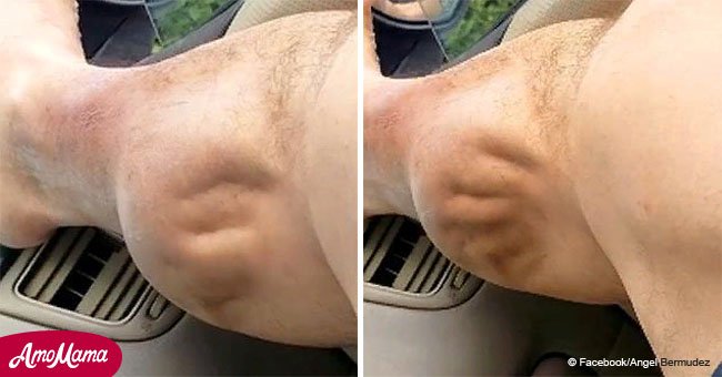 Video muestra intensos calambres musculares en la pantorrilla de un hombre