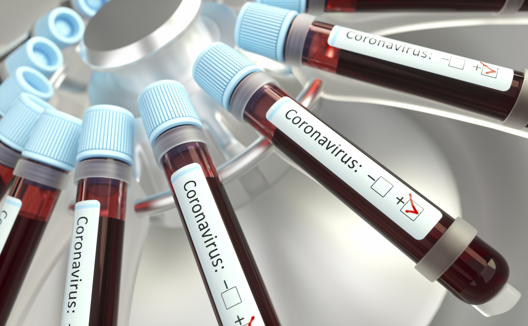 Investigación sobre el Coronavirus, ilustración conceptual.| Foto: Getty Images