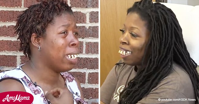 Tras sufrir burlas virales por sus dientes, campaña en línea le paga una nueva sonrisa