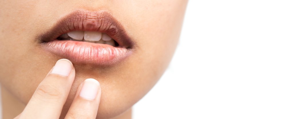 Mujer tocando sus labios resecos y agrietados. | Foto: Shutterstock