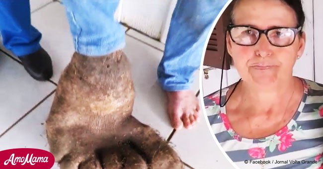 Mujer brasileña queda asombrada al hallar un "pie" entre sus batatas