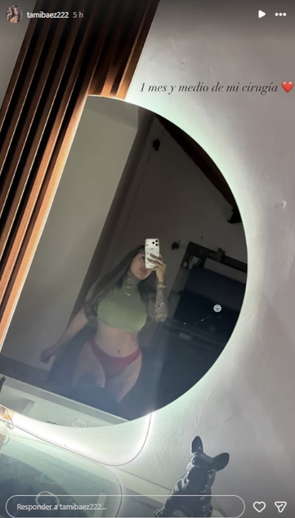 Tamara Báez muestra su cuerpo después de realizarse cirugía estética. | Fuente: Instagram/@tamibaez222