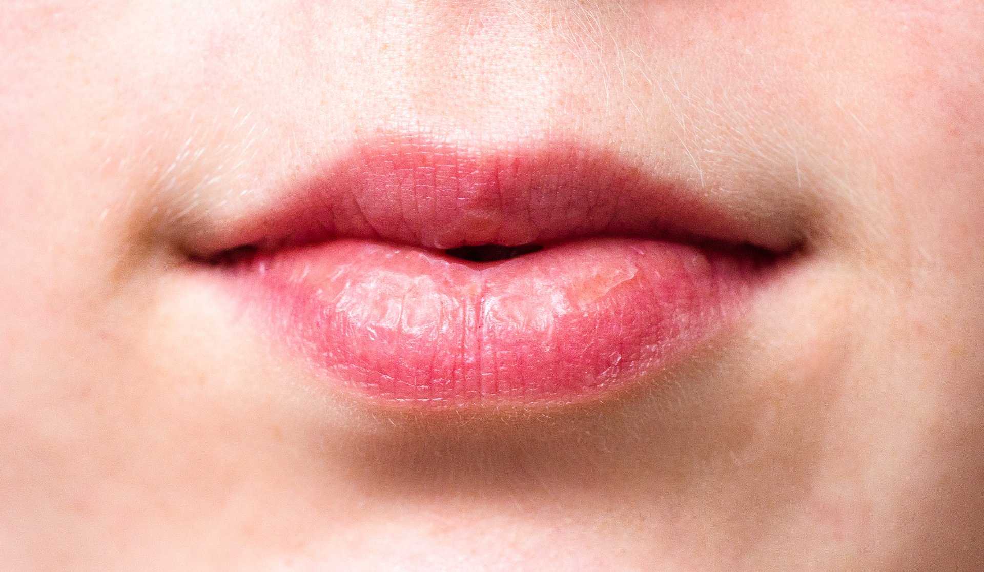 Labios secos. | Foto: Pixabay