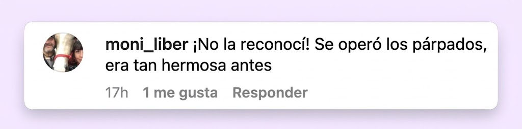 Una usuaria de Instagram comentó que los párpados de Lawrence parecían diferentes y dijo que le gustaba más cómo estaba antes. | Fuente: Instagram/ @thecut