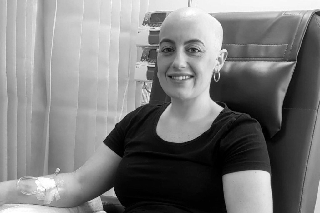 Alisha perdió el pelo por la quimioterapia. | Foto: Gofundme