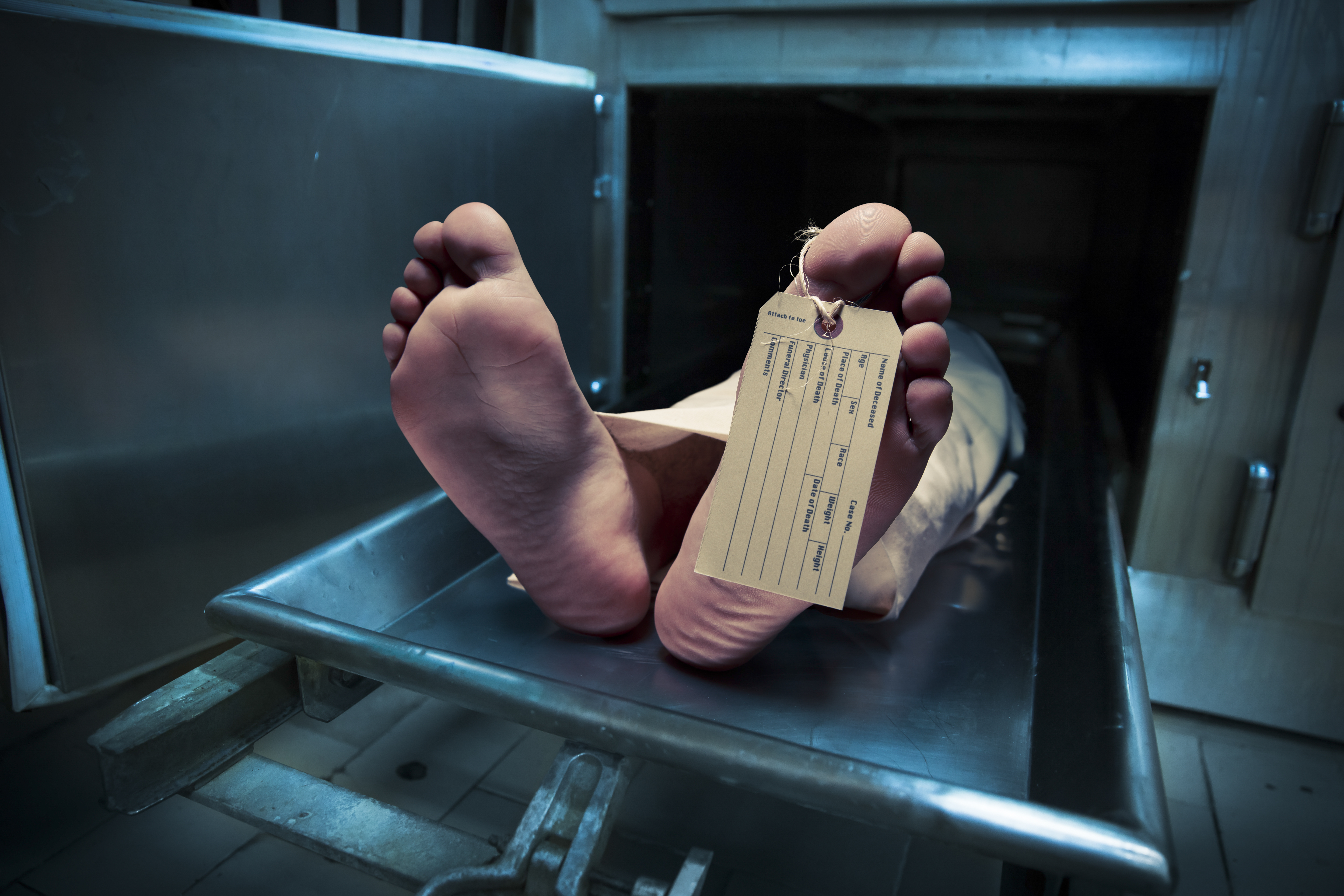 Cadaver en una morgue | Foto: Shutterstock