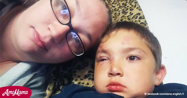 Niño de 6 años defiende a amigo acosado, pero su noble gesto recibe una respuesta brutal