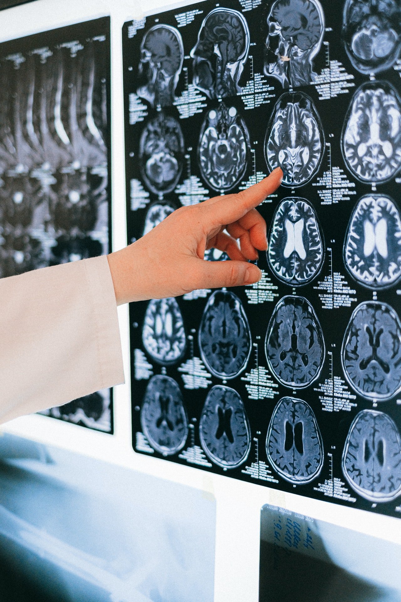 Doctor analizando una placa del cerebro. | Foto: Pexels
