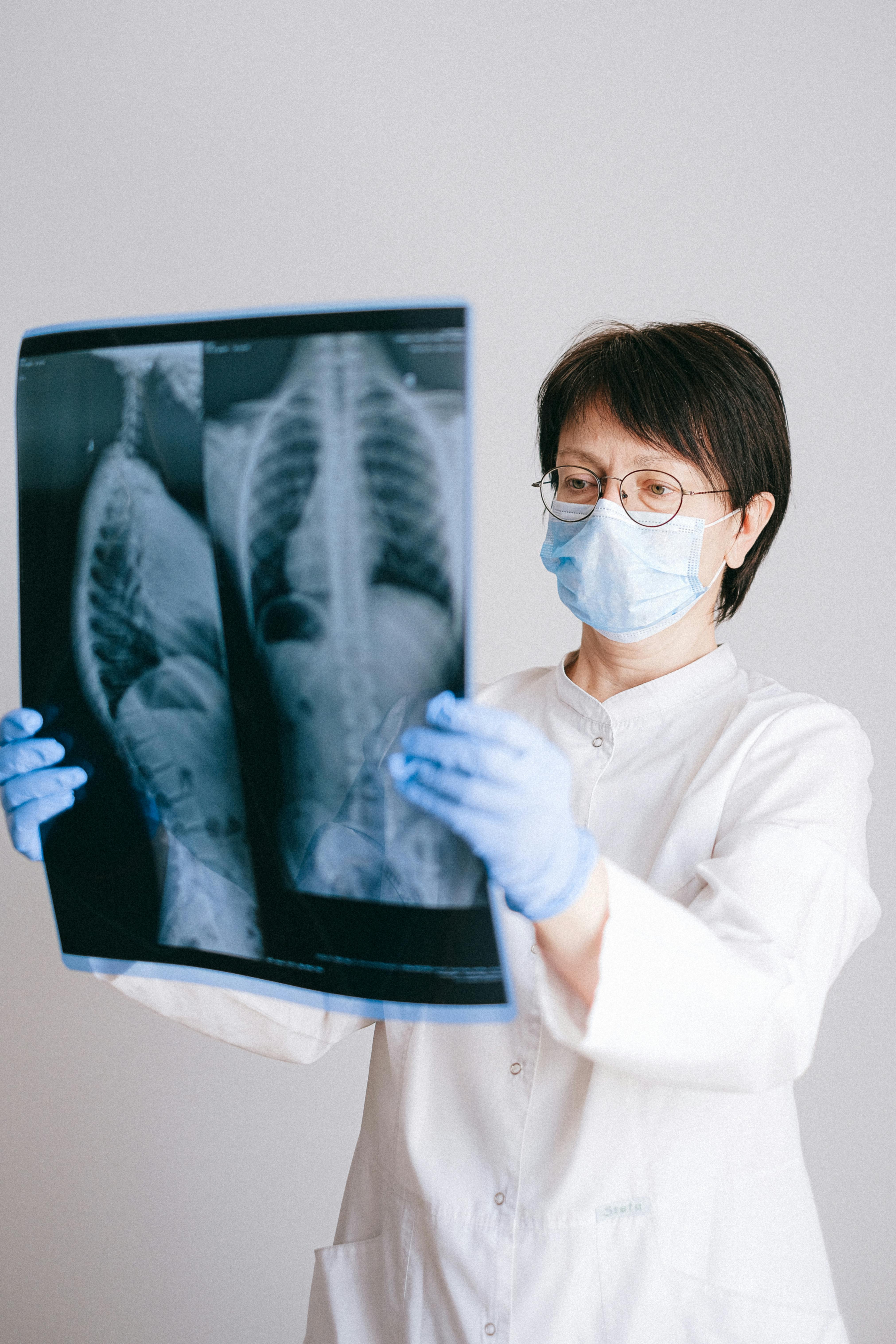 Un profesional médico observando una radiografía de pulmones | Fuente: Pexels