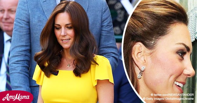 El motivo de la misteriosa cicatriz en el rostro de Kate Middleton fue revelado
