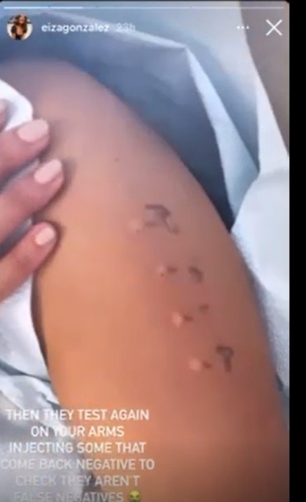 Captura de pantalla del test de alergias alimentarias de Eiza González. | Foto: Instagram/ eizagonzalez