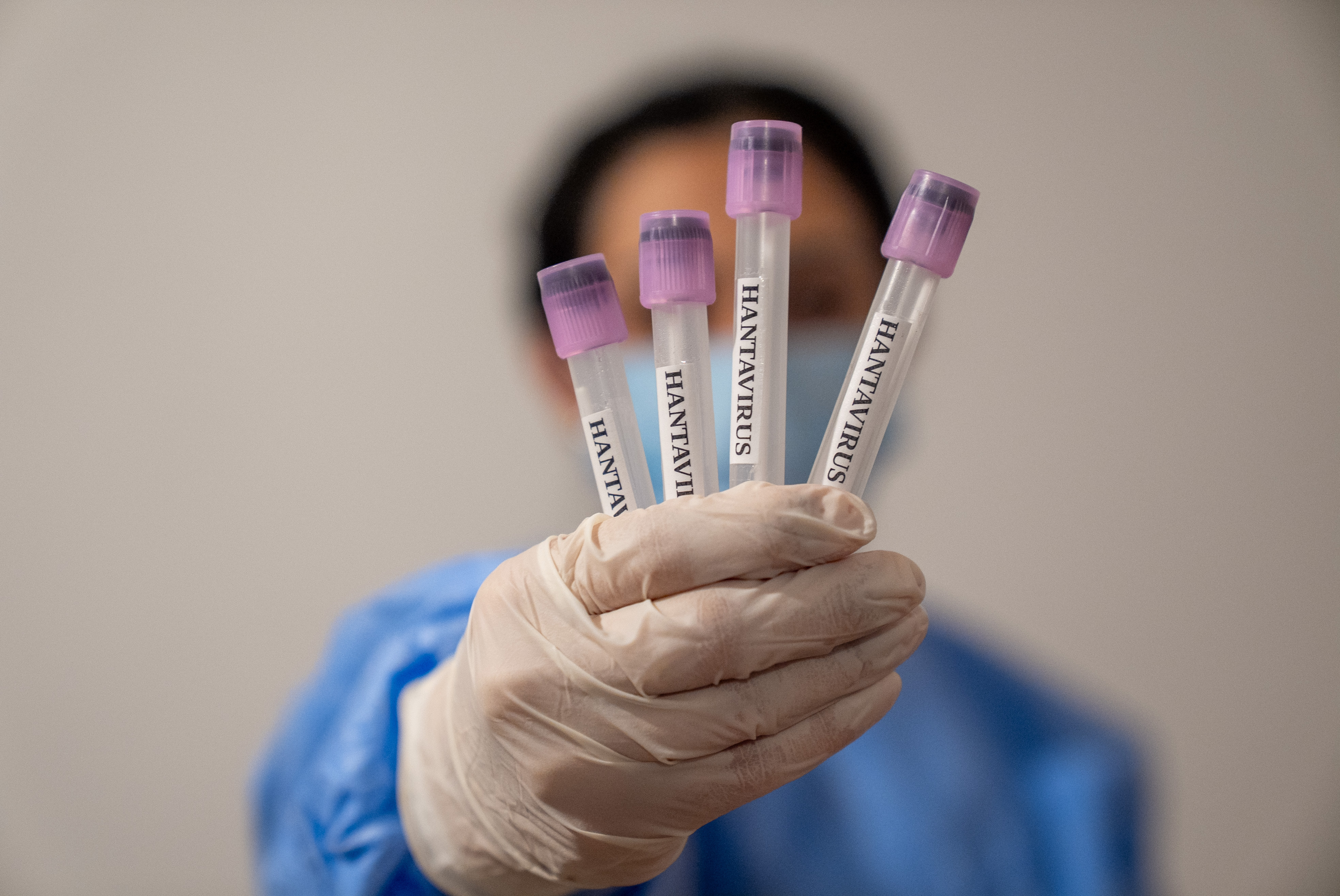 Médica mostrando muestras de hantavirus, 6 de mayo de 2026. | Fuente: Getty Images