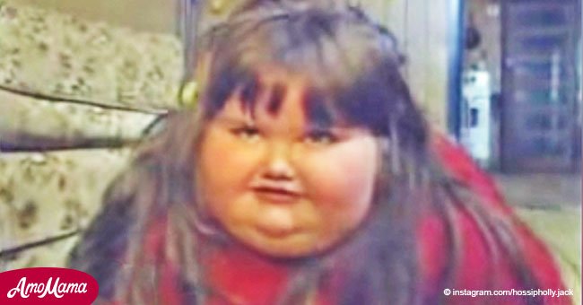 Con 8 años pesaba 190kg y podía morir. Entonces la "niña más pesada del mundo" perdió más de 130kg
