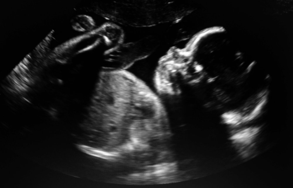 Ultrasonido de un bebé en el útero de una madre. I Foto: Shutterstock