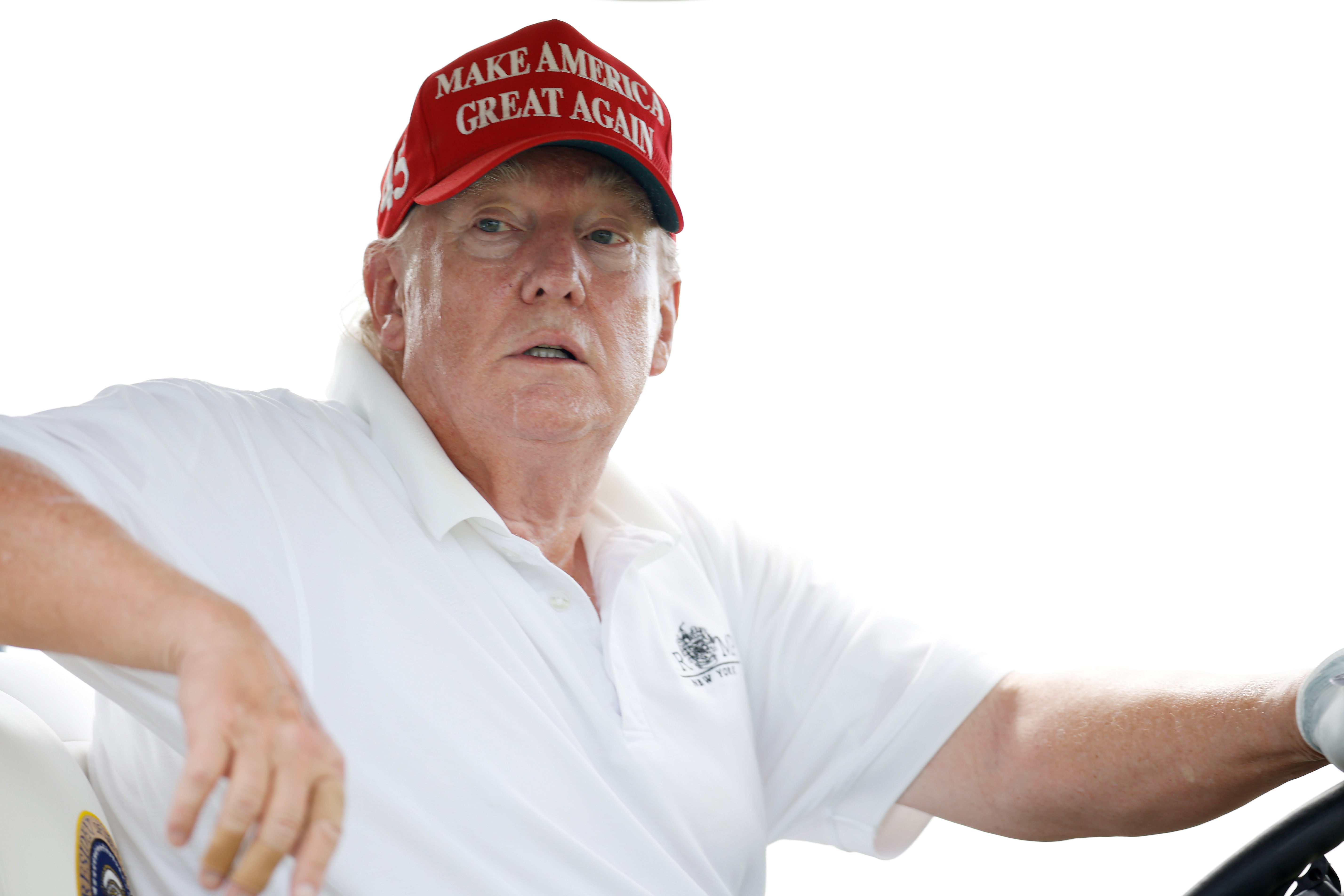 En un primer plano mientras conduce el carro, la piel de Donald Trump aparece enrojecida alrededor de las mejillas y los ojos, con zonas más pálidas cerca de las orejas y el cuello. Su camisa permanece abierta por el cuello, revelando más contraste de tono.